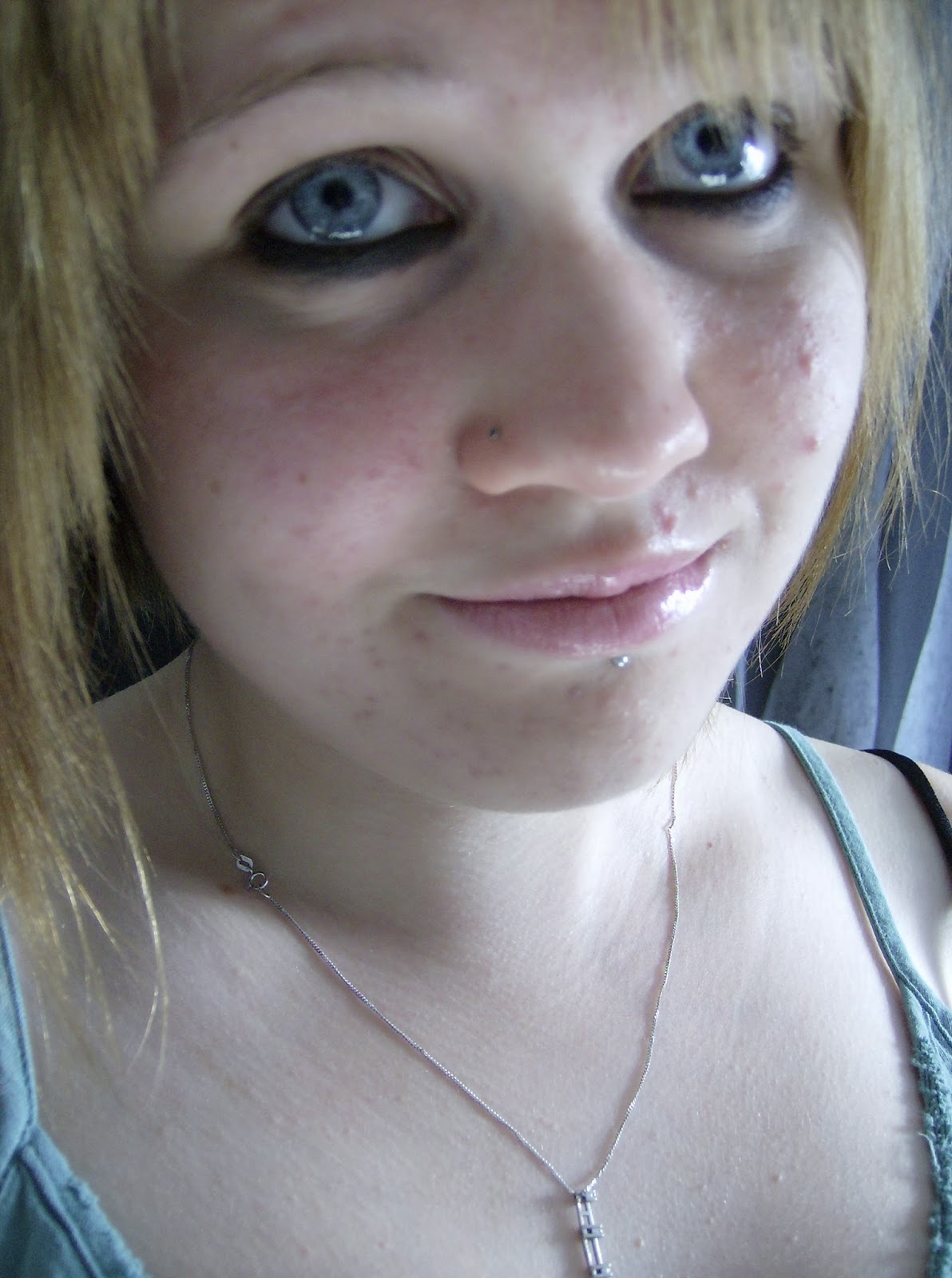 Early what stop if you accutane